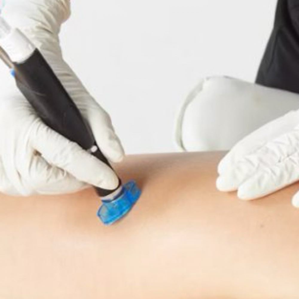 Body Hydrafacial at Skin Seed in Turlock, CA