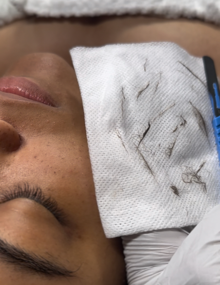 Dermaplane Add On at Loba Beauty Spa in Paterson, NJ