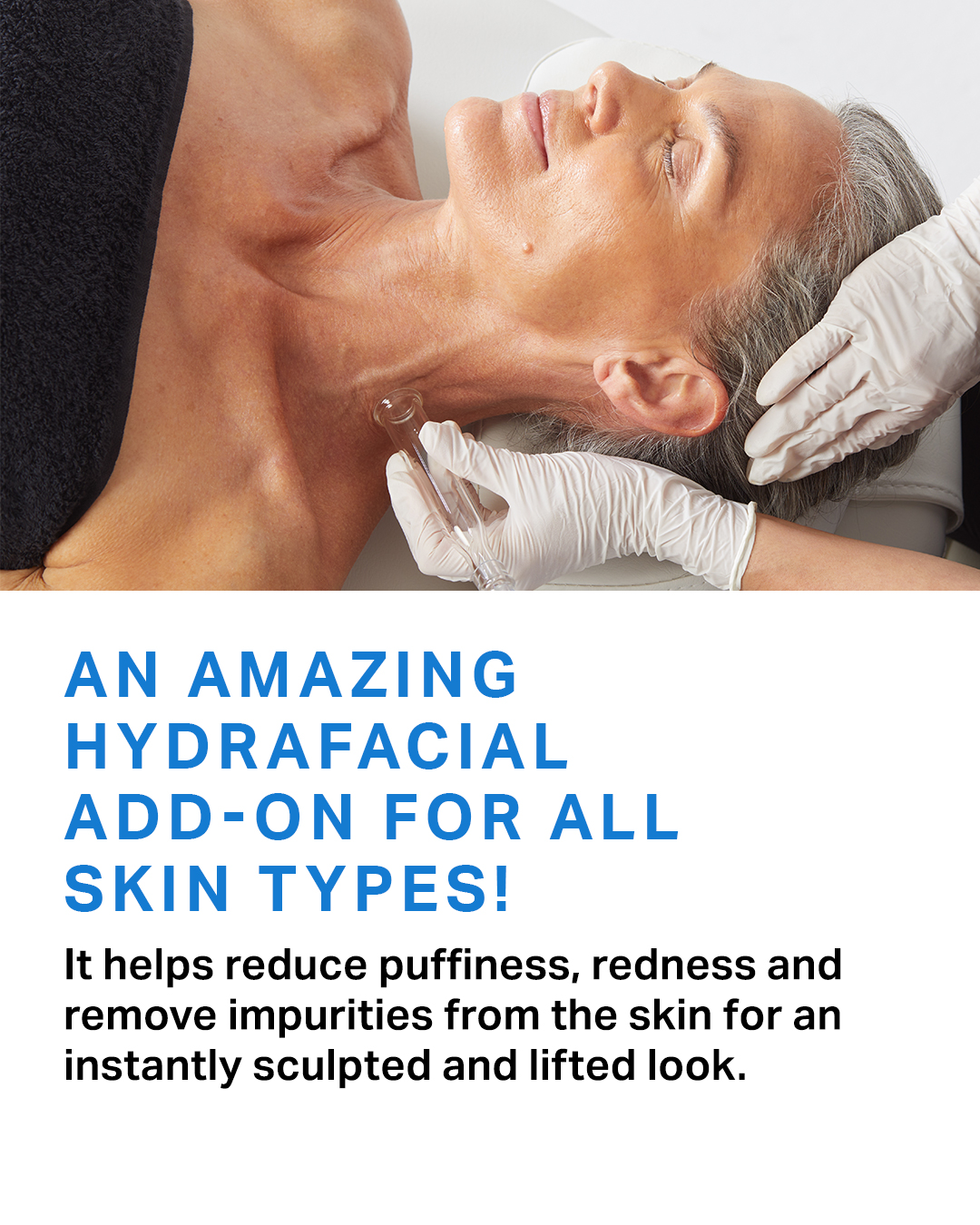 💎 Eternal Elegance Facial