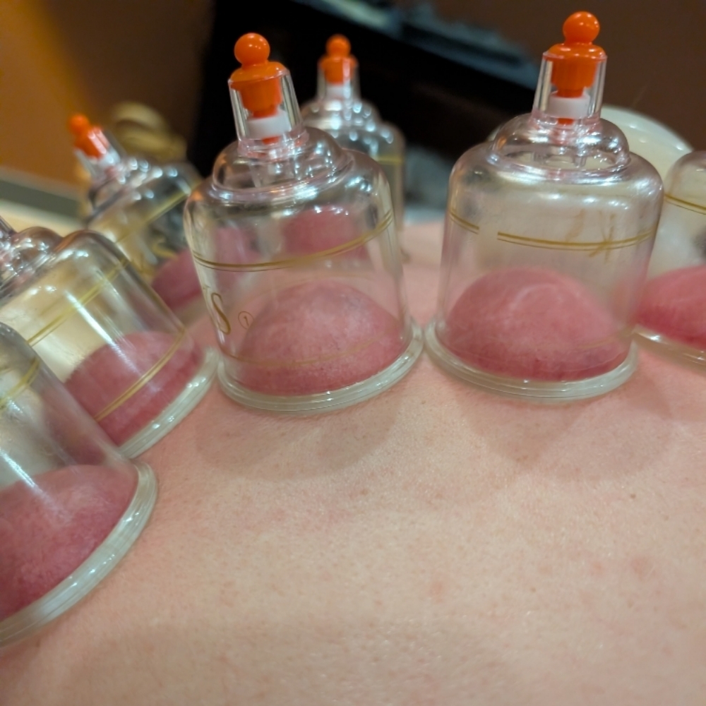 Massage With Modern Cupping at Nervana Massage & Cupping in Clarksville, IN