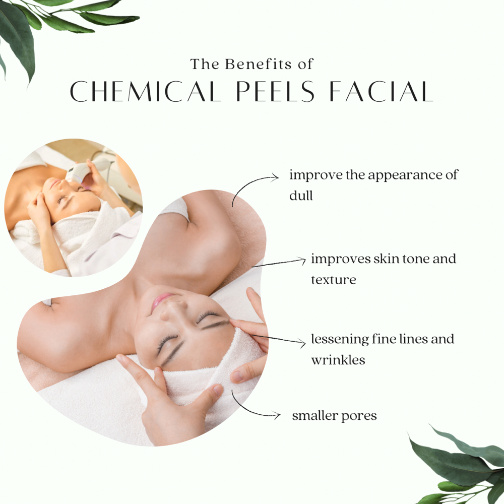 Ad-on Chemical Peel