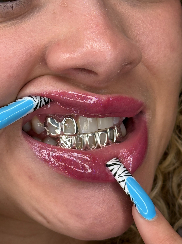 Grillz Impression