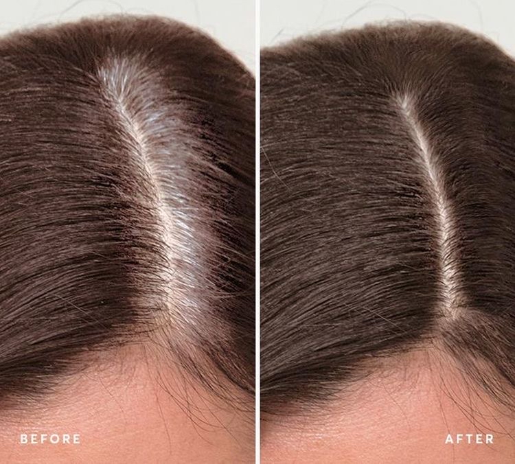 Root Touch Up