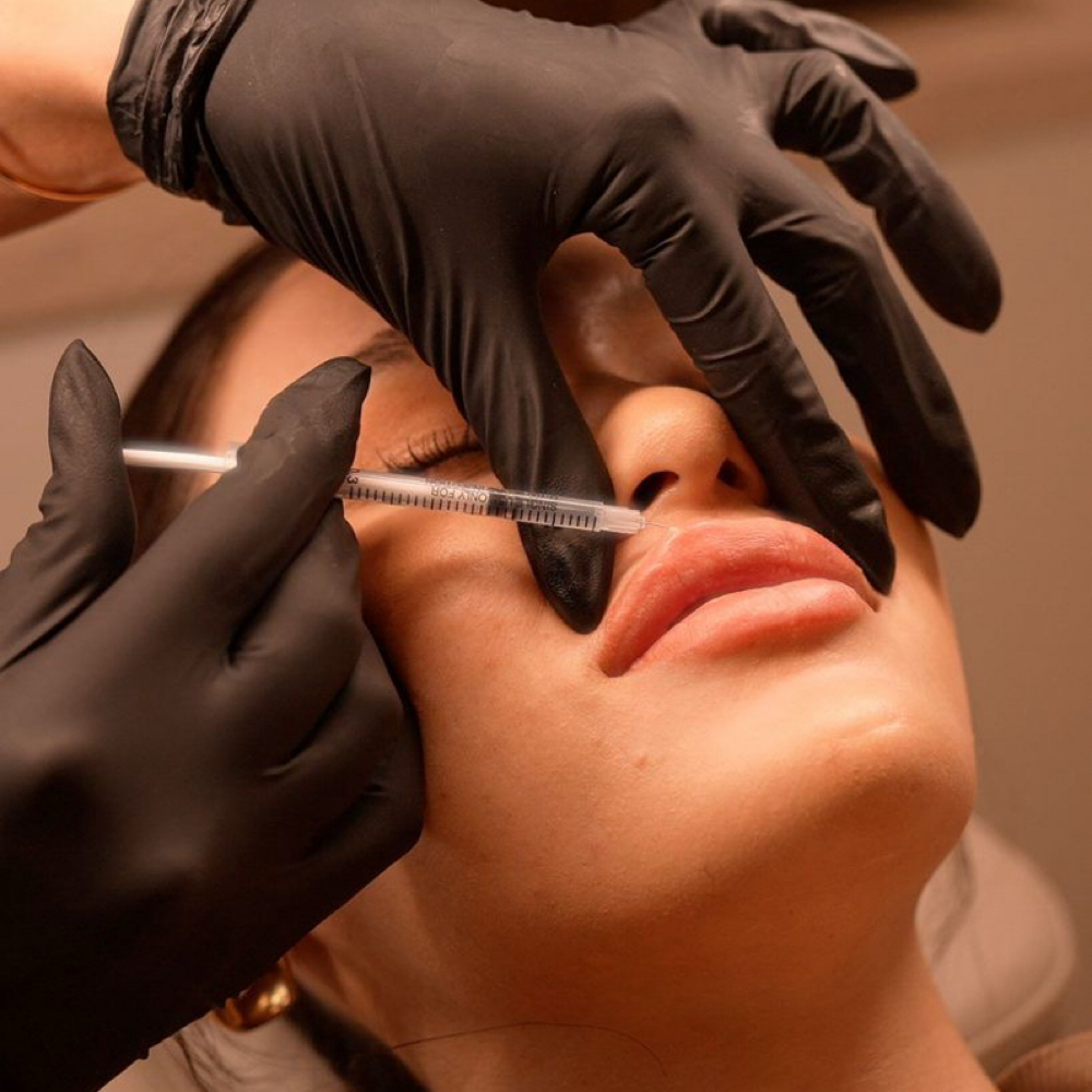 Lip Filler Full Syringe at SKN on Main in Dennis, MA