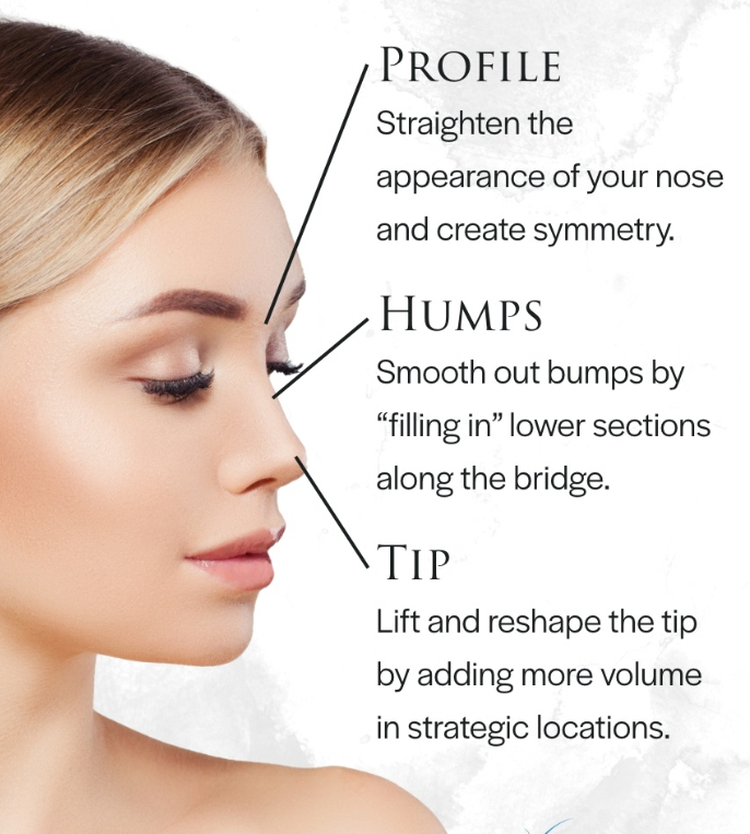 Liquid Rhinoplasty (Nose Filler)