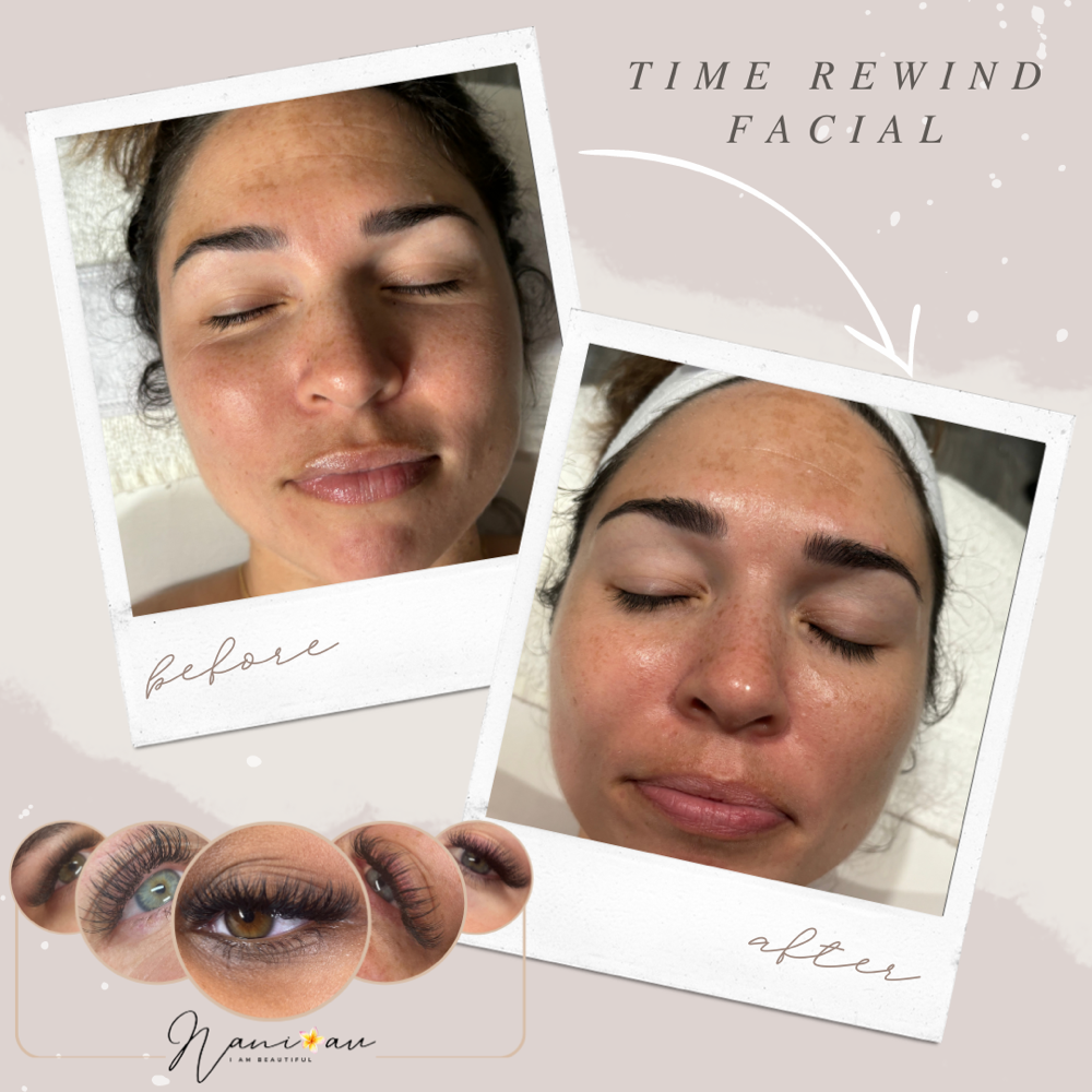 Time Rewind Facial