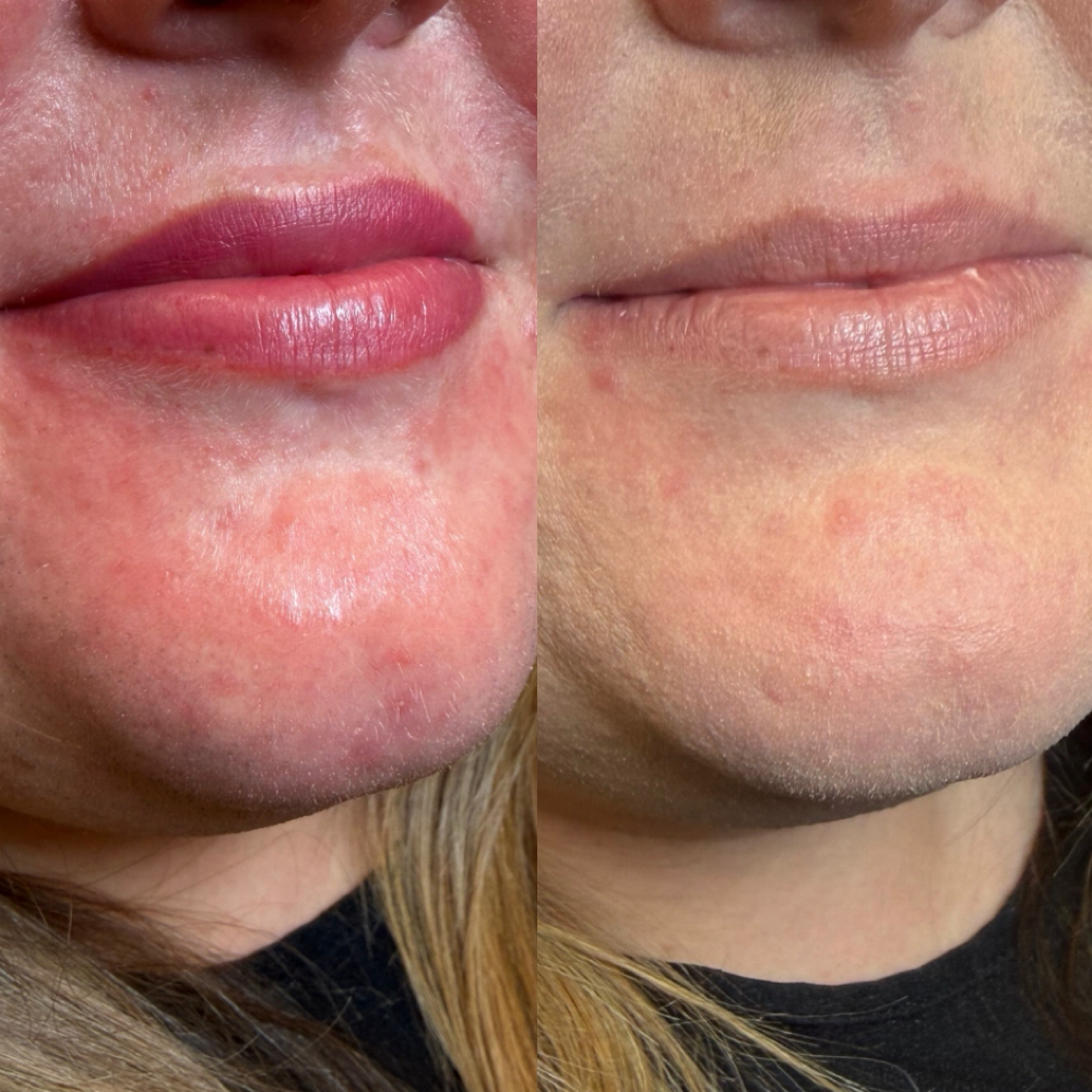 Lip Blush at Bare. in Fayetteville, AR