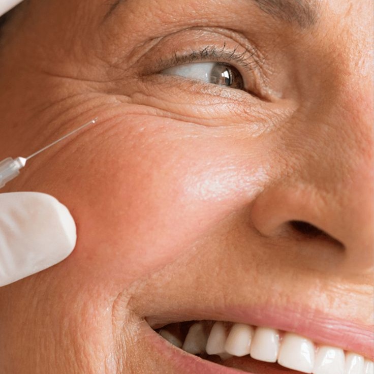Tox- Botox at Monogram Med Spa in Harrisonburg, VA