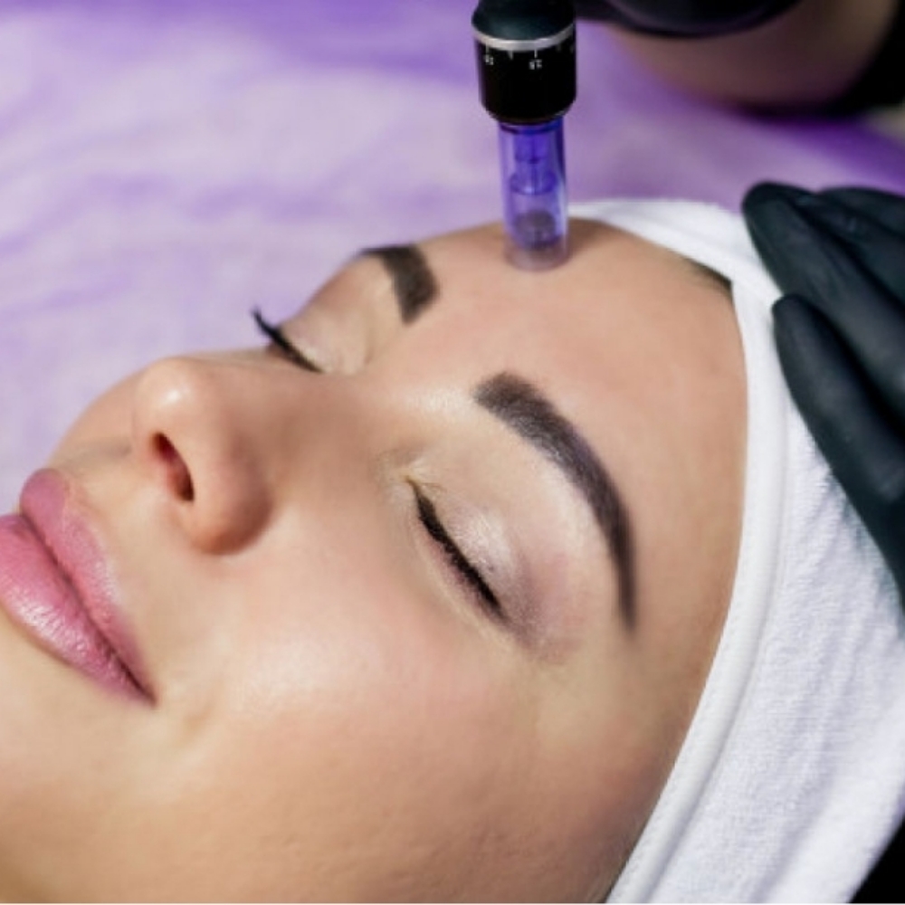 Microneedling Package at REFRESH BEAUTY BAR in Hampstead, NC