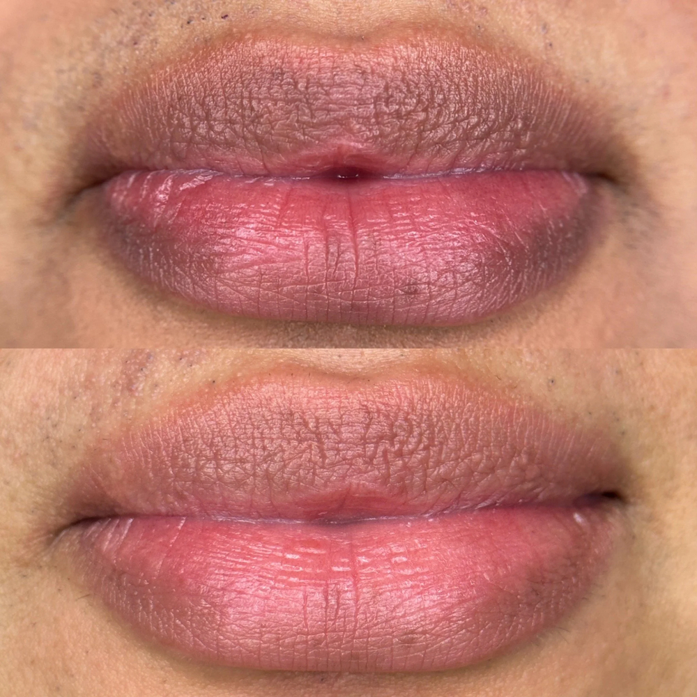 Lip Neutralization