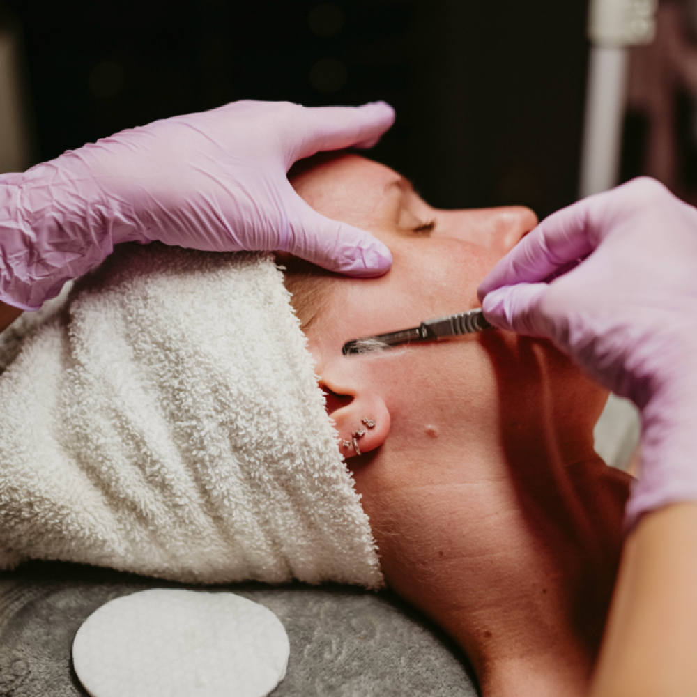 Timeless Dermaplane Facial at Timeless Glow in Eagar, AZ