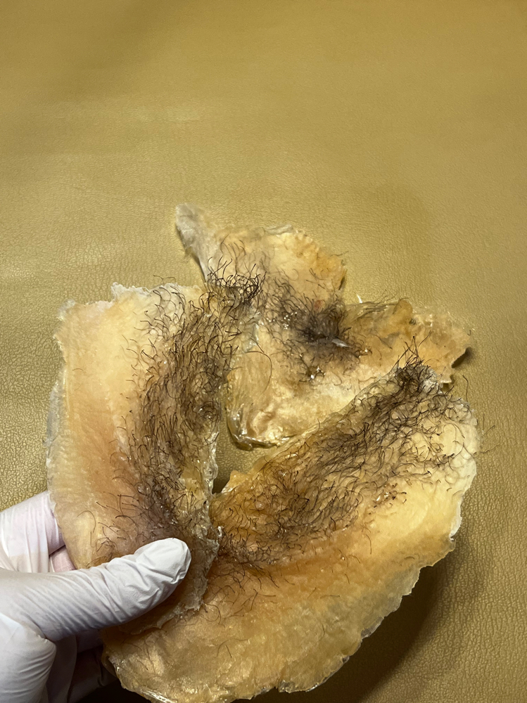Brazilian Wax