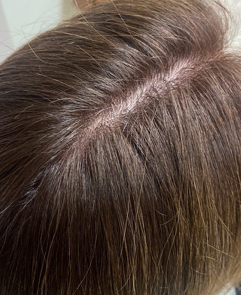 Root Touch Up
