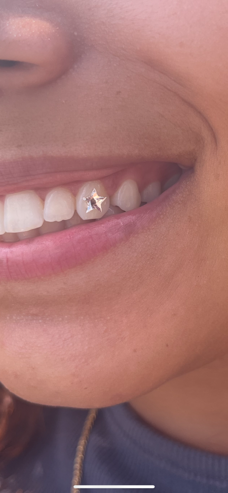 ‘Star’ Tooth Gem