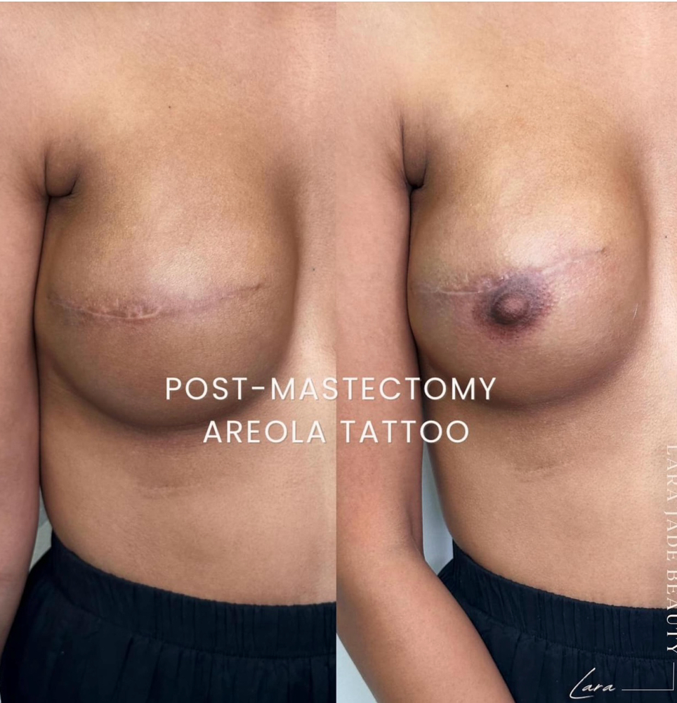 3D Areola Tattoo