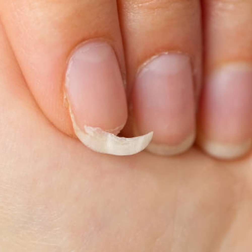 Nail Repair at Ikole Beauty * Indigo Nail Stylist in Alexandria, VA