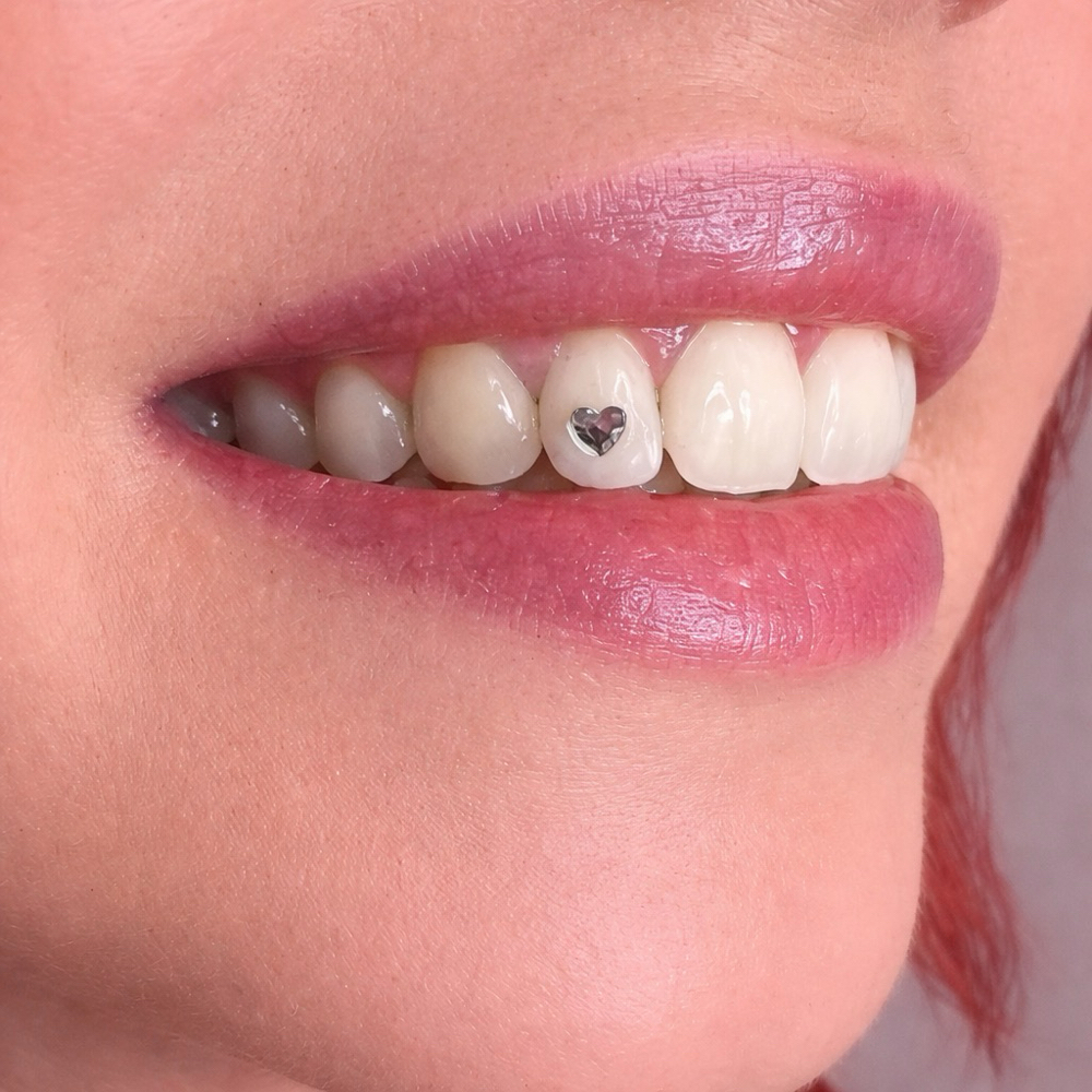 Shaped Gems — Curated Detail at Luna Smiles in Lexington, SC
