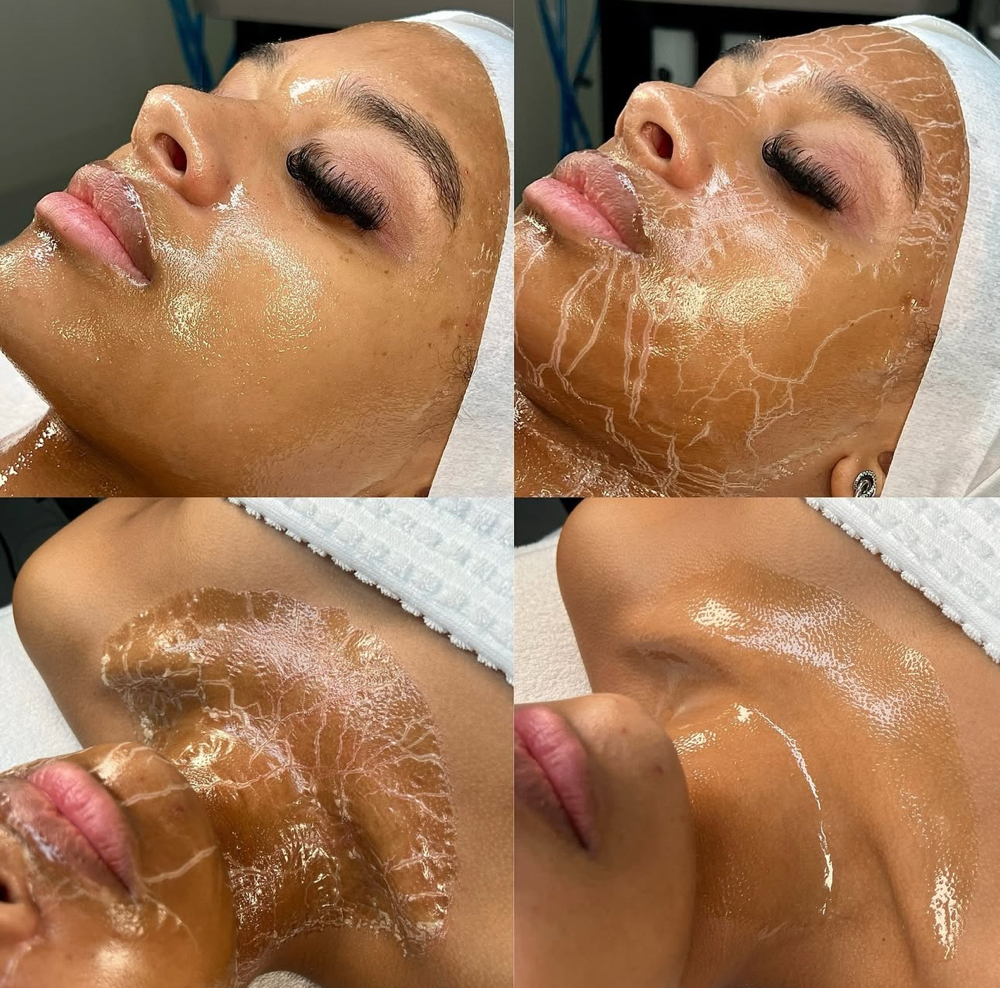 The renewal facial