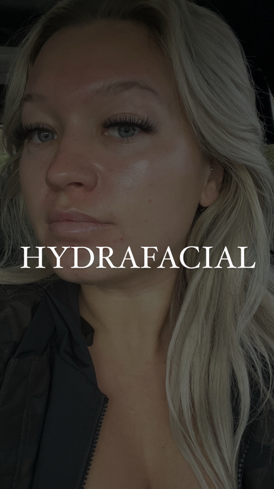 Deluxe HydraFacial (45 Mins)
