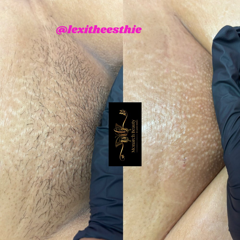 Brazilian Wax