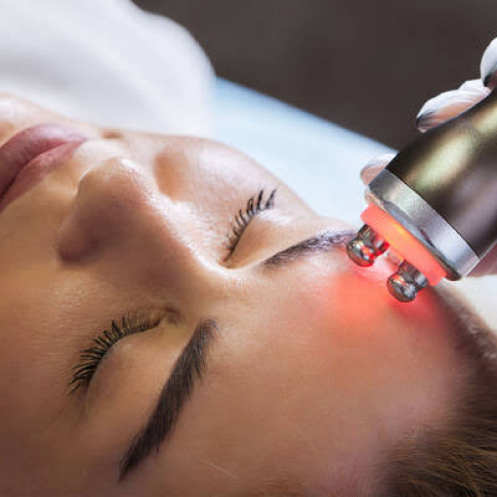 RF Facial at CALI BELLA BODY SCULPTING in Redding, CA