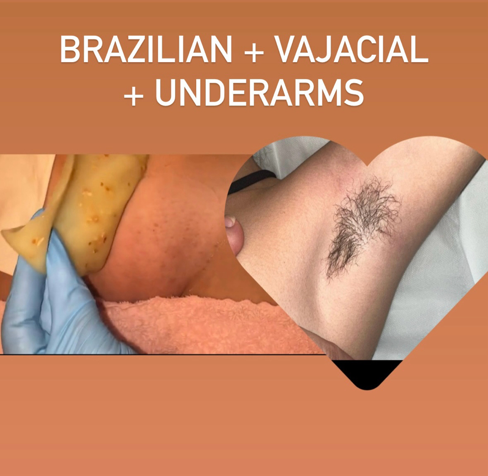 Brazilian + Vajacial + Underarms