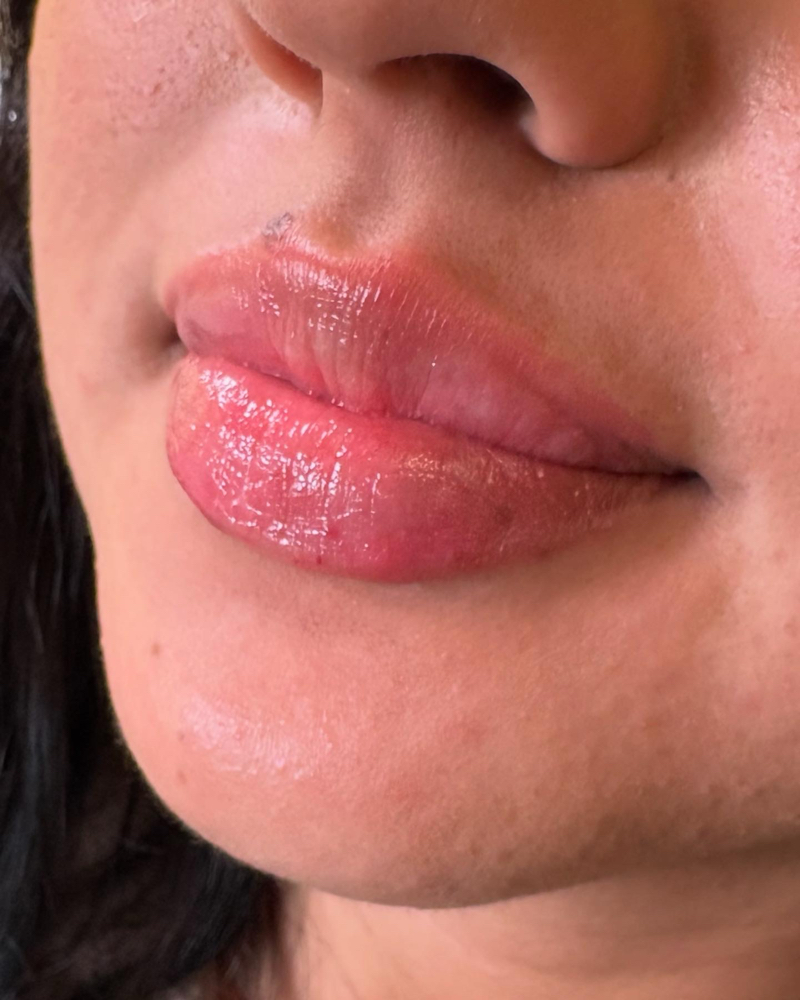 Mini Lip