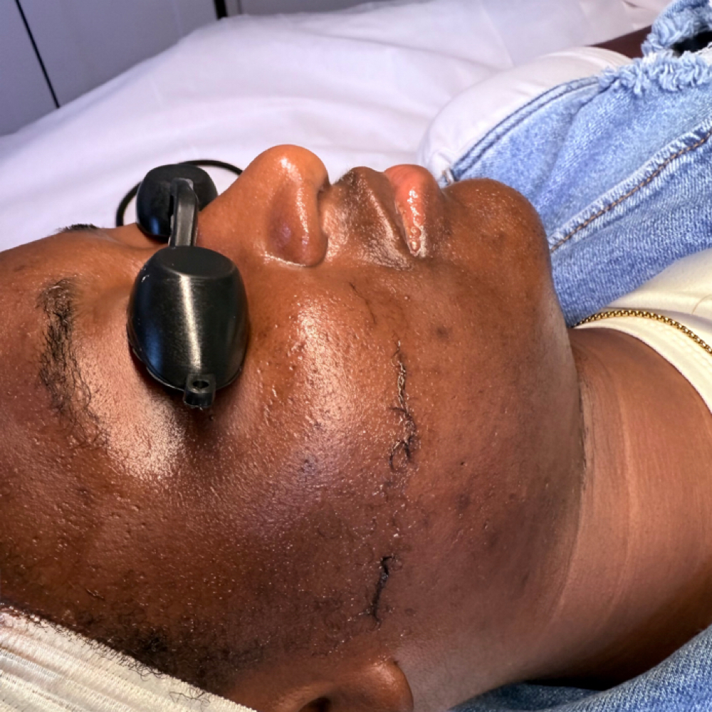Dermaplaning at Skin by Amile in Oxon Hill, MD