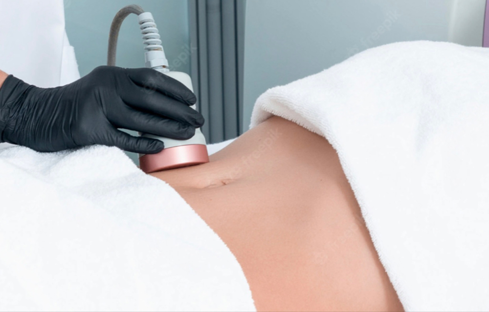 Ultrasonic-Cavitation Session