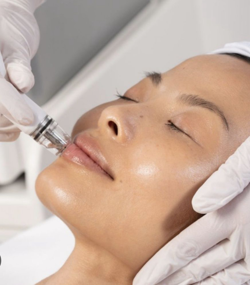 Glow Dermabrasion+ fruit enzyme+LED