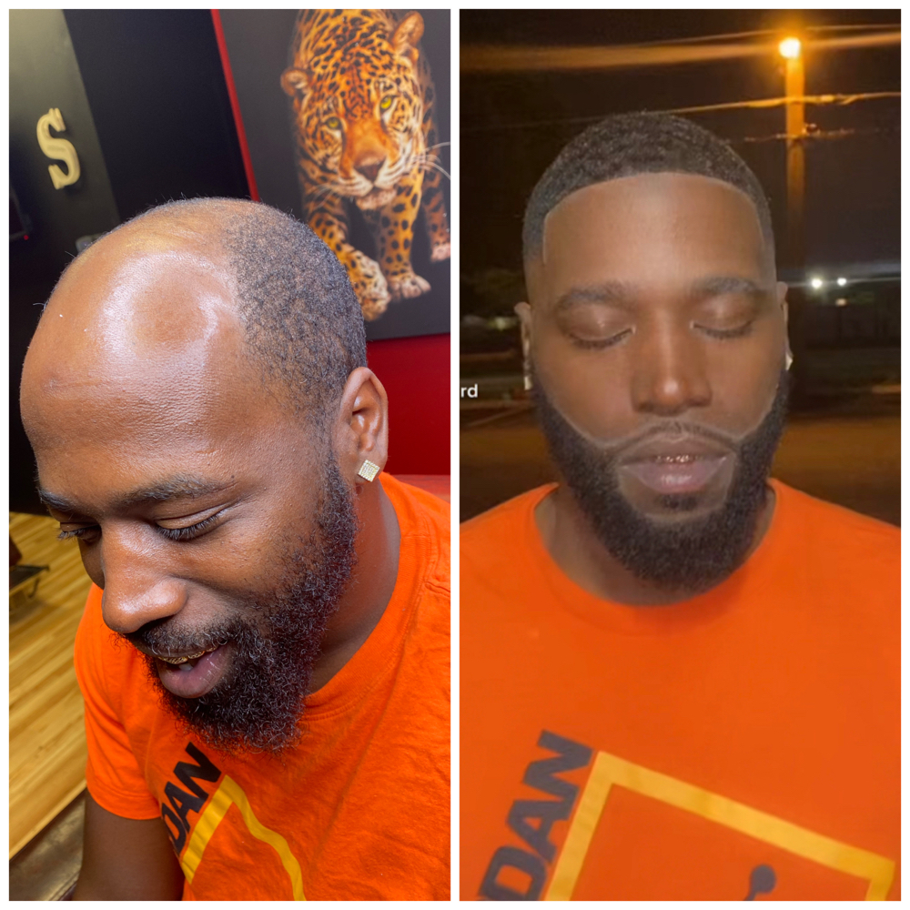 HAIR UNITS