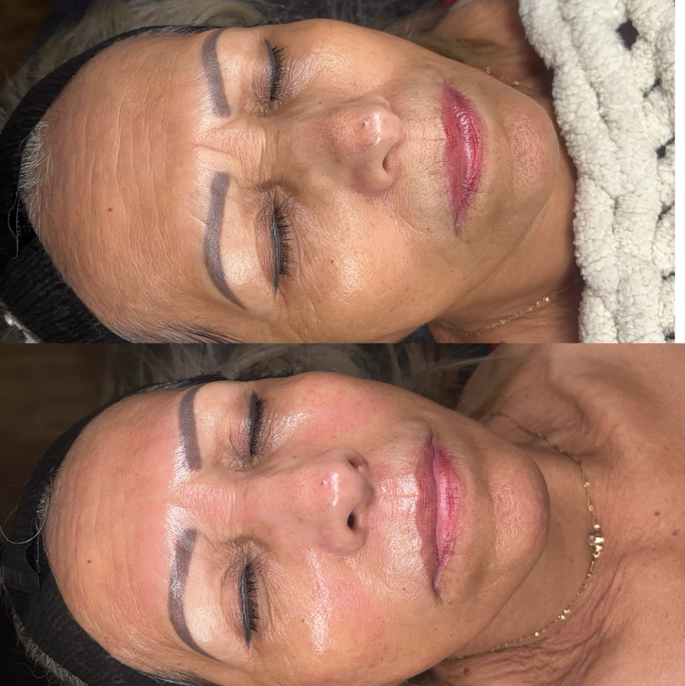 Switch Facial