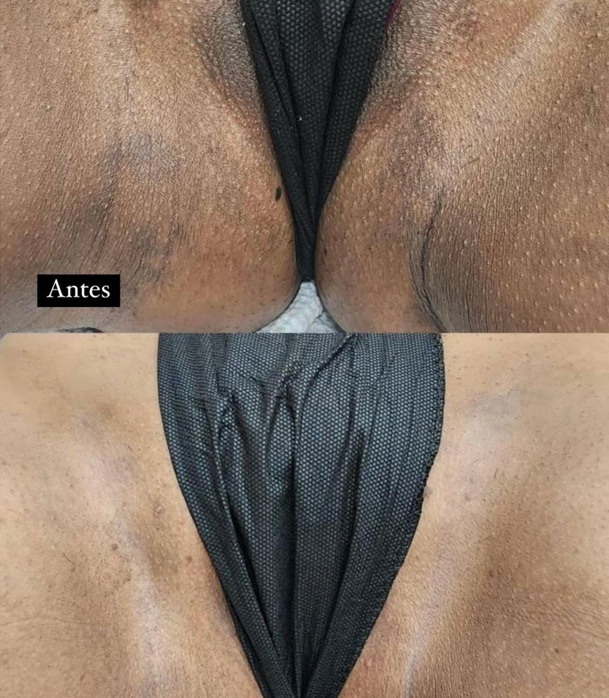 Intimate Bleaching