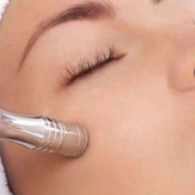 Microdermabrasion Facial at Skin Utopia in San Mateo, CA
