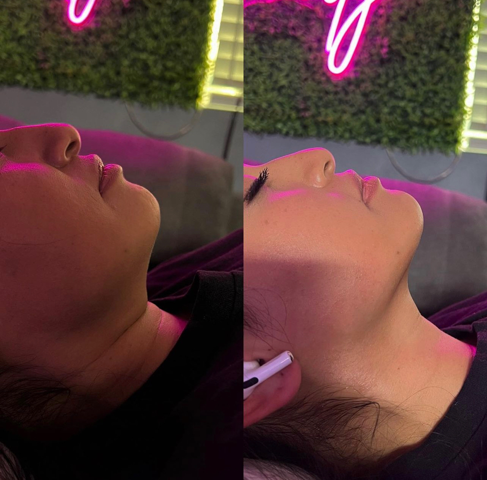 goodbye double chin (express)