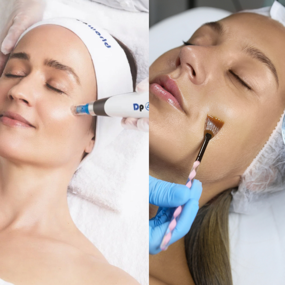 Bowie Boost (VI Peel & Microneedle) at Bowie Aesthetics & Wellness LLC in Trinidad, CO