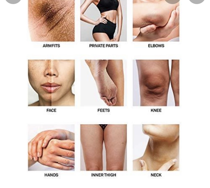 Intimate Bleaching