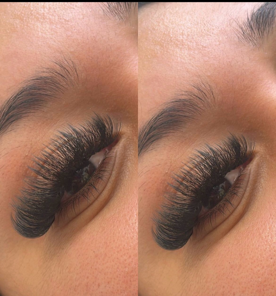 Mega Volume Fill
