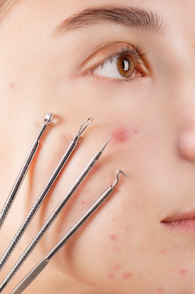 Extractions Add-on