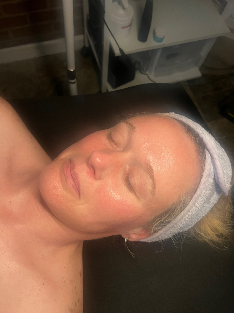 Anti-aging Facial