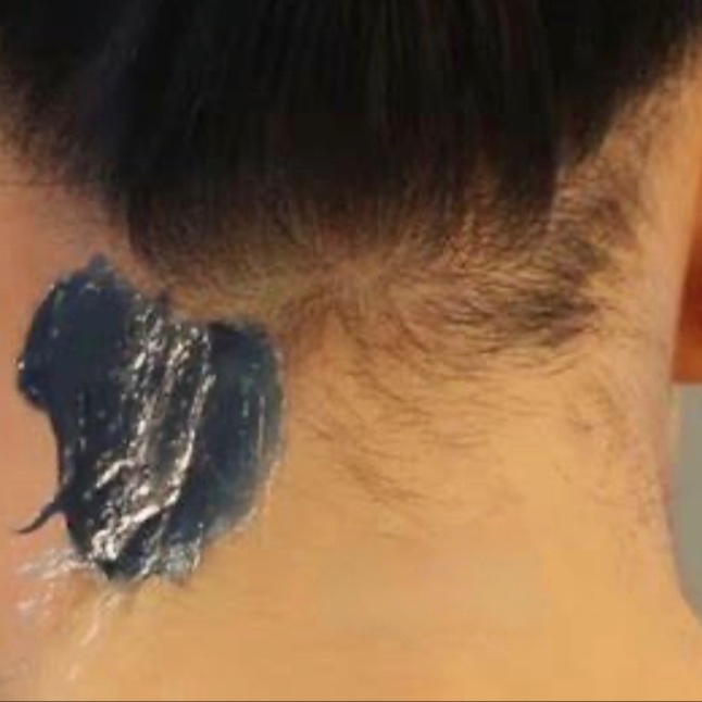 Neck at Skin Utopia in San Mateo, CA