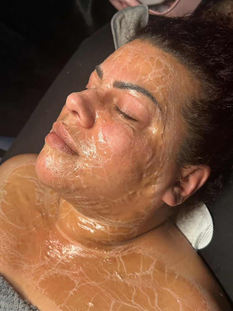 Glow Tox Treatment at EstheticsbyMilanea in Rockford, IL