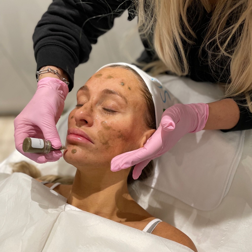 BioHerb 50 Peel Alternative