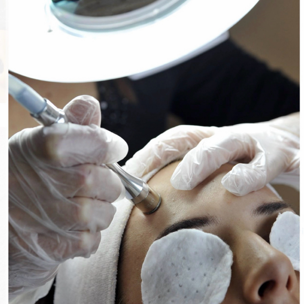 EXPRESS MICRODERMABRASION