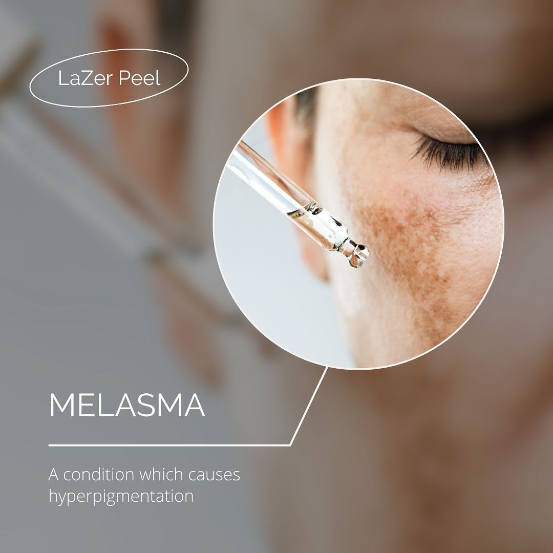 Underarm LaZer Peel Bundle