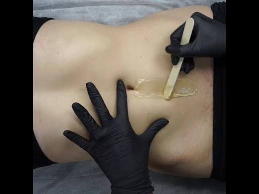 Stomach Strip at Desthetics Beauty in Bronx, NY