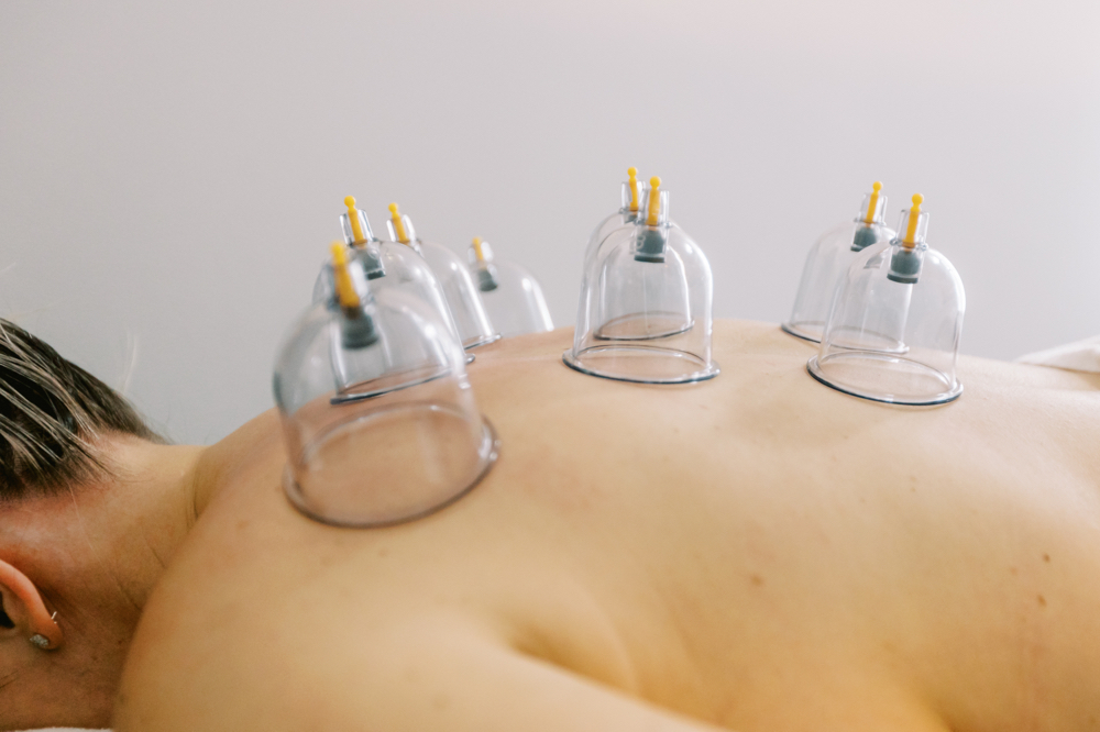Cupping (Add on to Any Massage)