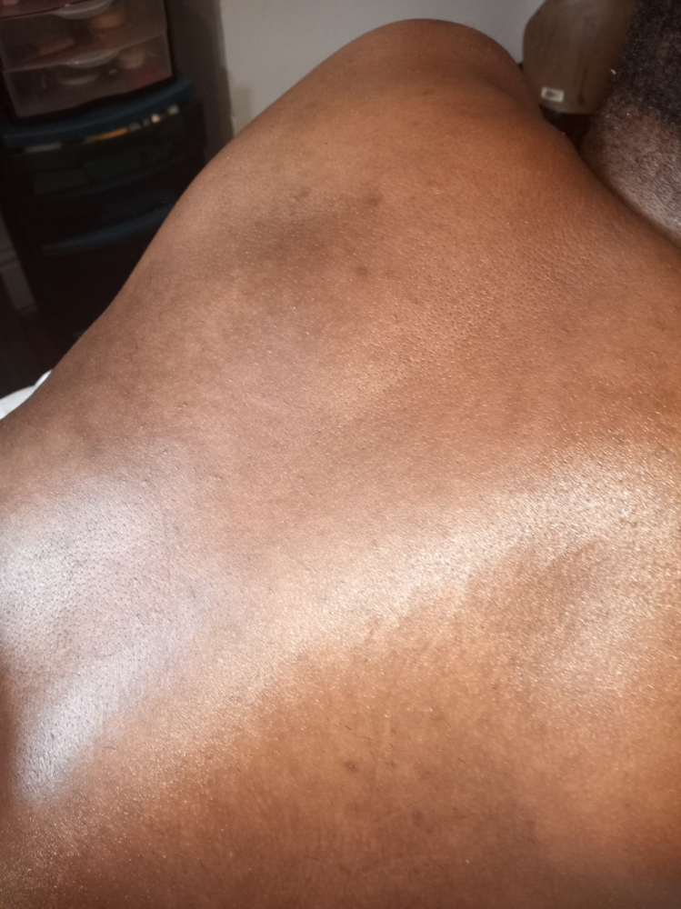 Mens Back & Top Of Arms Sugaring