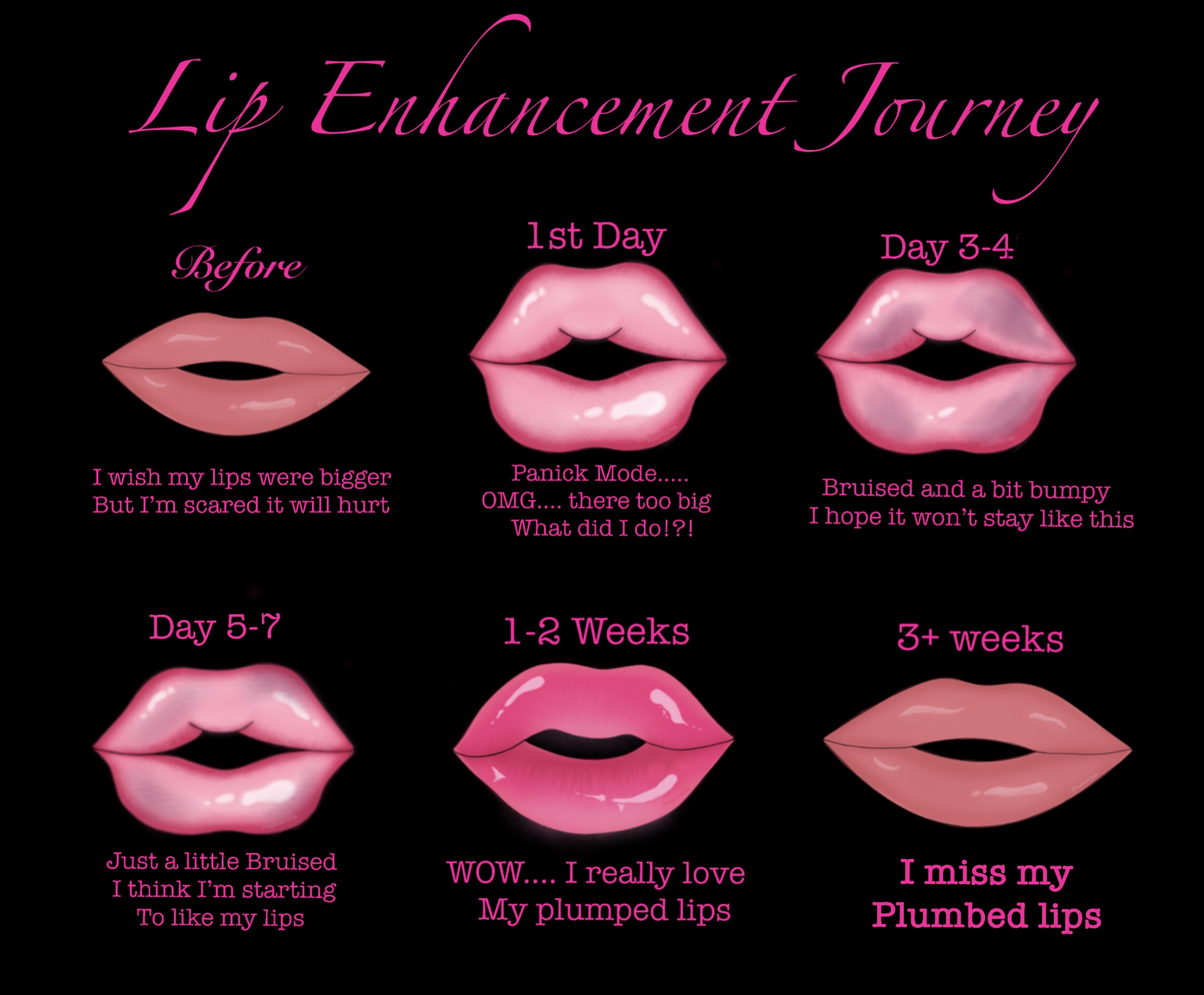 Lip-licious 1 Ml