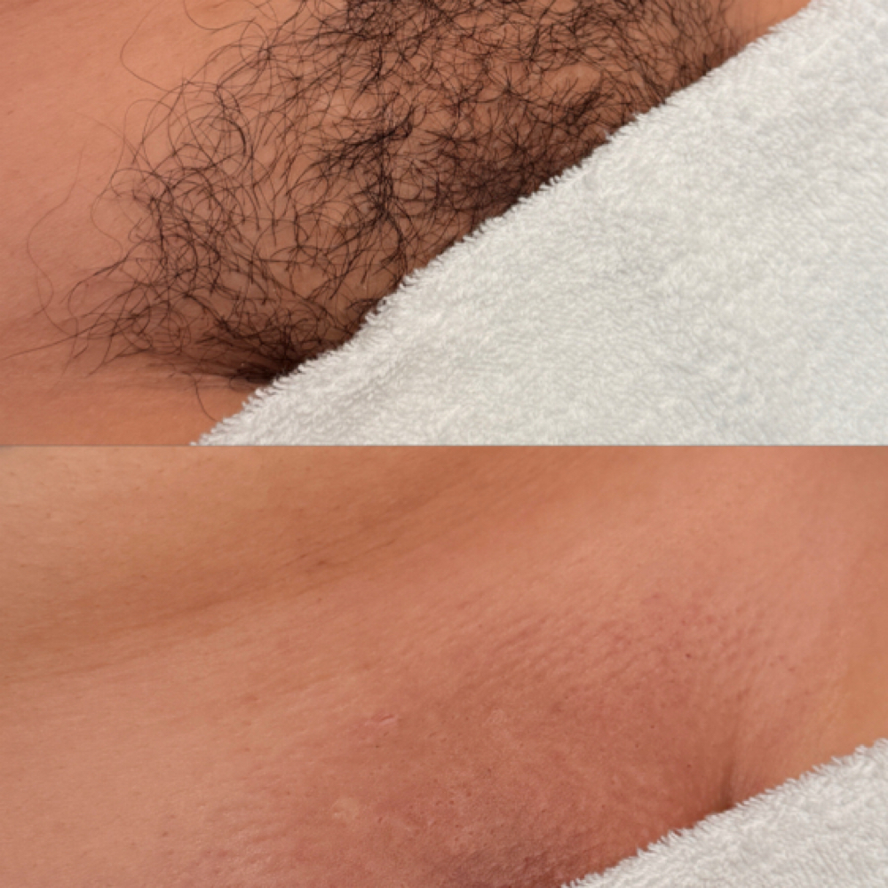 Brazilian Waxes at Chula Beautyy in Los Alamitos, CA